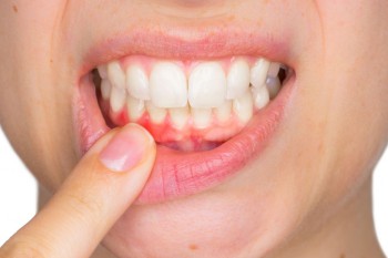 Darıca Diş Polikliniği Periodontoloji